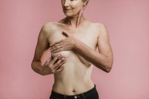 Elderly woman showing how to massage her scar tissue